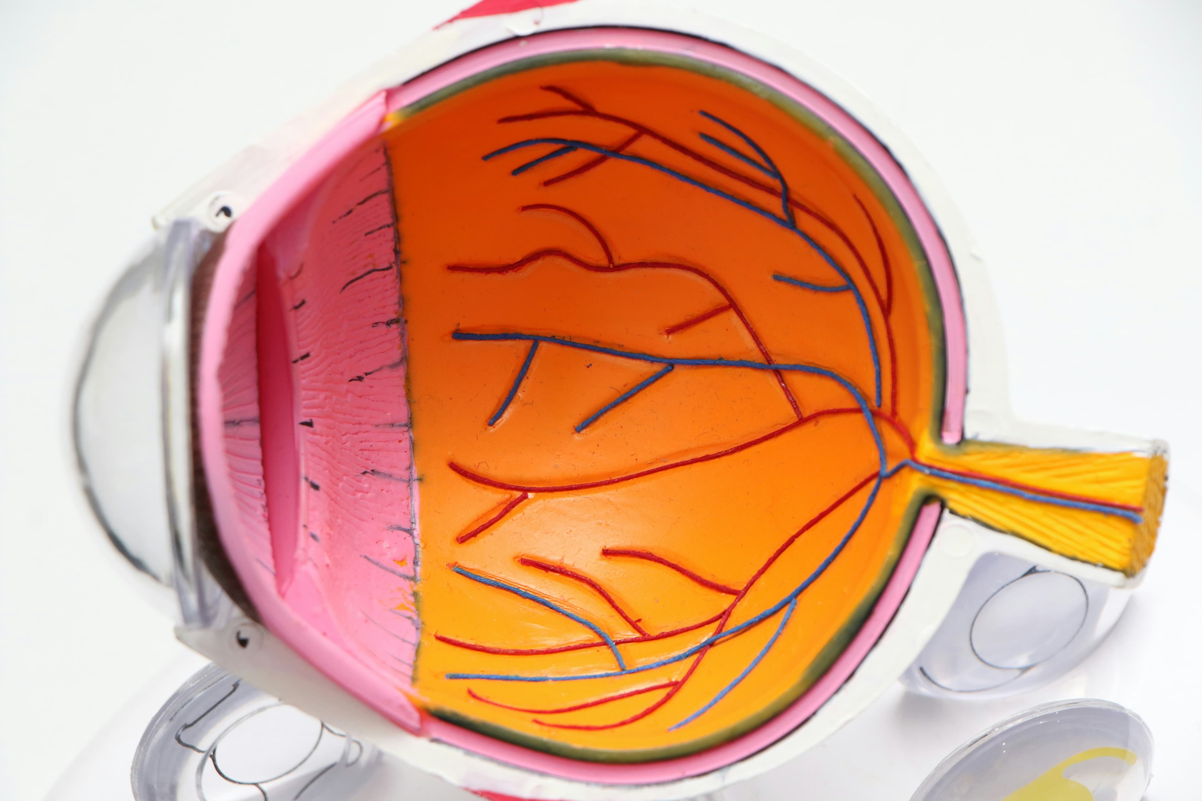 Diagnosi e Trattamento Glaucoma